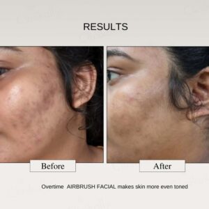 The FormulaRx Air Brush Facial Lactic Acid Exfoliating Serum - Image 5