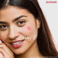 D'Acne Face Wash - Image 5