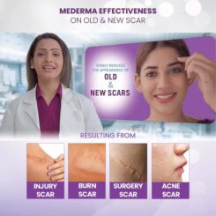 Mederma Skincare Scar Gel - Image 5