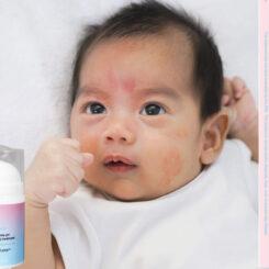Soteri Skin BEBE Skin - Image 5